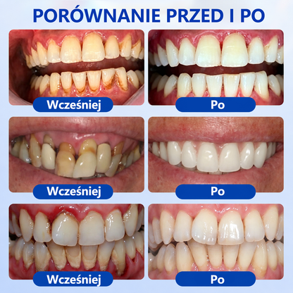 💉💉 𝑮𝒍𝒊𝒎𝒎𝒆𝒓𝒍𝒚® 𝑮𝒖𝒎𝑹𝒆𝒗𝒊𝒗𝒆 𝒁̇𝒆𝒍 𝒅𝒐 𝑹𝒆𝒈𝒆𝒏𝒆𝒓𝒂𝒄𝒋𝒊 𝑫𝒛𝒊𝒂̨𝒔𝒆ł