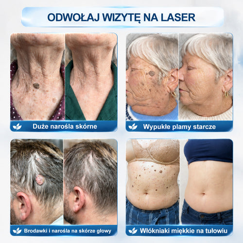 𝐏i𝐜𝐝o®7 𝑫𝒏𝒊 𝑷𝒓𝒆𝒑𝒂𝒓𝒂𝒕 𝑫𝒐 𝑼𝒔𝒖𝒘𝒂𝒏𝒊𝒂 𝑾łó𝒌𝒏𝒊𝒂𝒌ó𝒘 𝑴𝒊ę𝒌𝒌𝒊𝒄𝒉 𝑰 𝑷𝒓𝒛𝒆𝒃𝒂𝒓𝒘𝒊𝒆ń(𝐁𝐞𝐳 𝐁ó𝐥𝐮, 𝐁𝐞𝐳 𝐁𝐥𝐢𝐳𝐧 – 𝐑𝐨𝐥𝐥-𝐨𝐧)🩵🩵