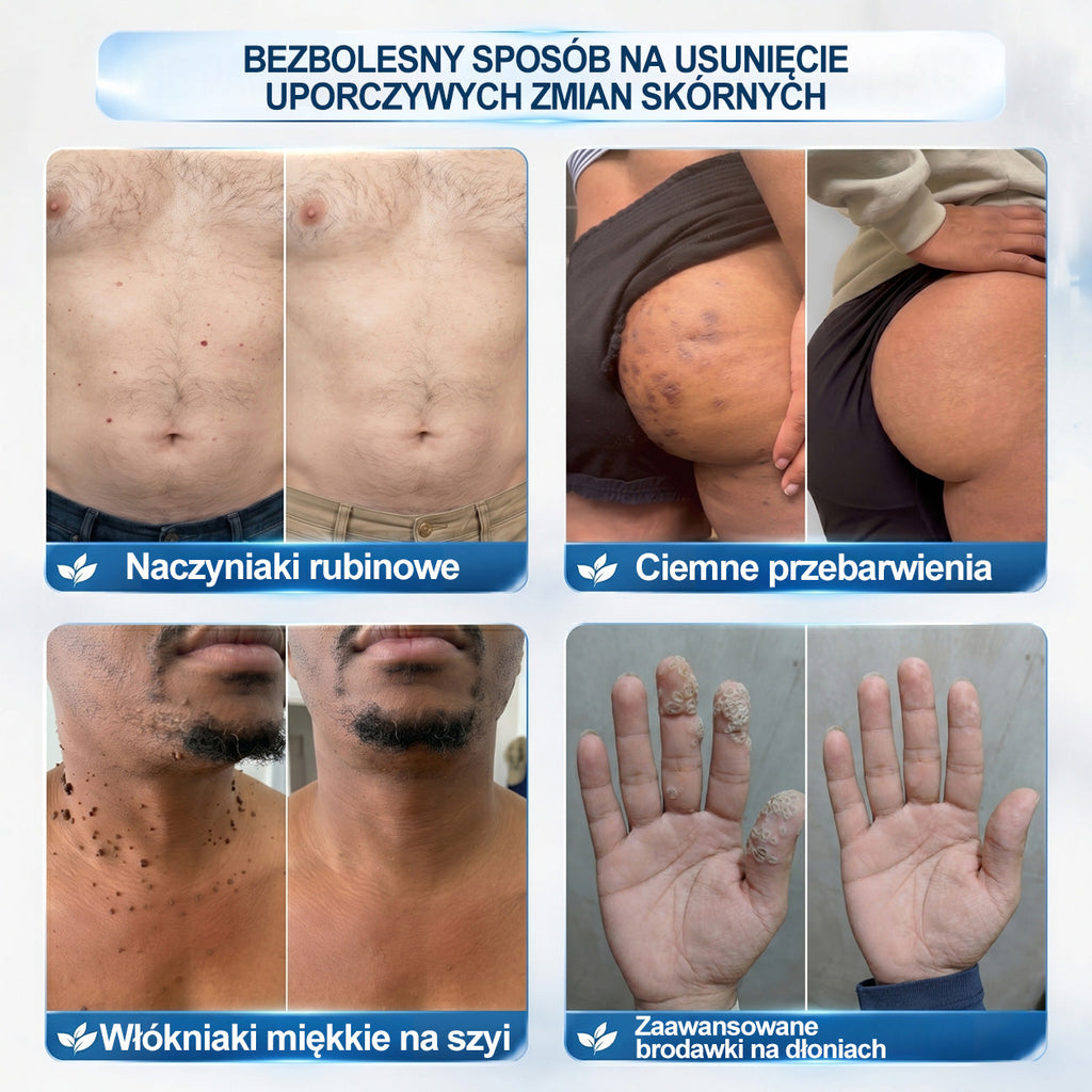𝐏i𝐜𝐝o®7 𝑫𝒏𝒊 𝑷𝒓𝒆𝒑𝒂𝒓𝒂𝒕 𝑫𝒐 𝑼𝒔𝒖𝒘𝒂𝒏𝒊𝒂 𝑾łó𝒌𝒏𝒊𝒂𝒌ó𝒘 𝑴𝒊ę𝒌𝒌𝒊𝒄𝒉 𝑰 𝑷𝒓𝒛𝒆𝒃𝒂𝒓𝒘𝒊𝒆ń(𝐁𝐞𝐳 𝐁ó𝐥𝐮, 𝐁𝐞𝐳 𝐁𝐥𝐢𝐳𝐧 – 𝐑𝐨𝐥𝐥-𝐨𝐧)💜💜
