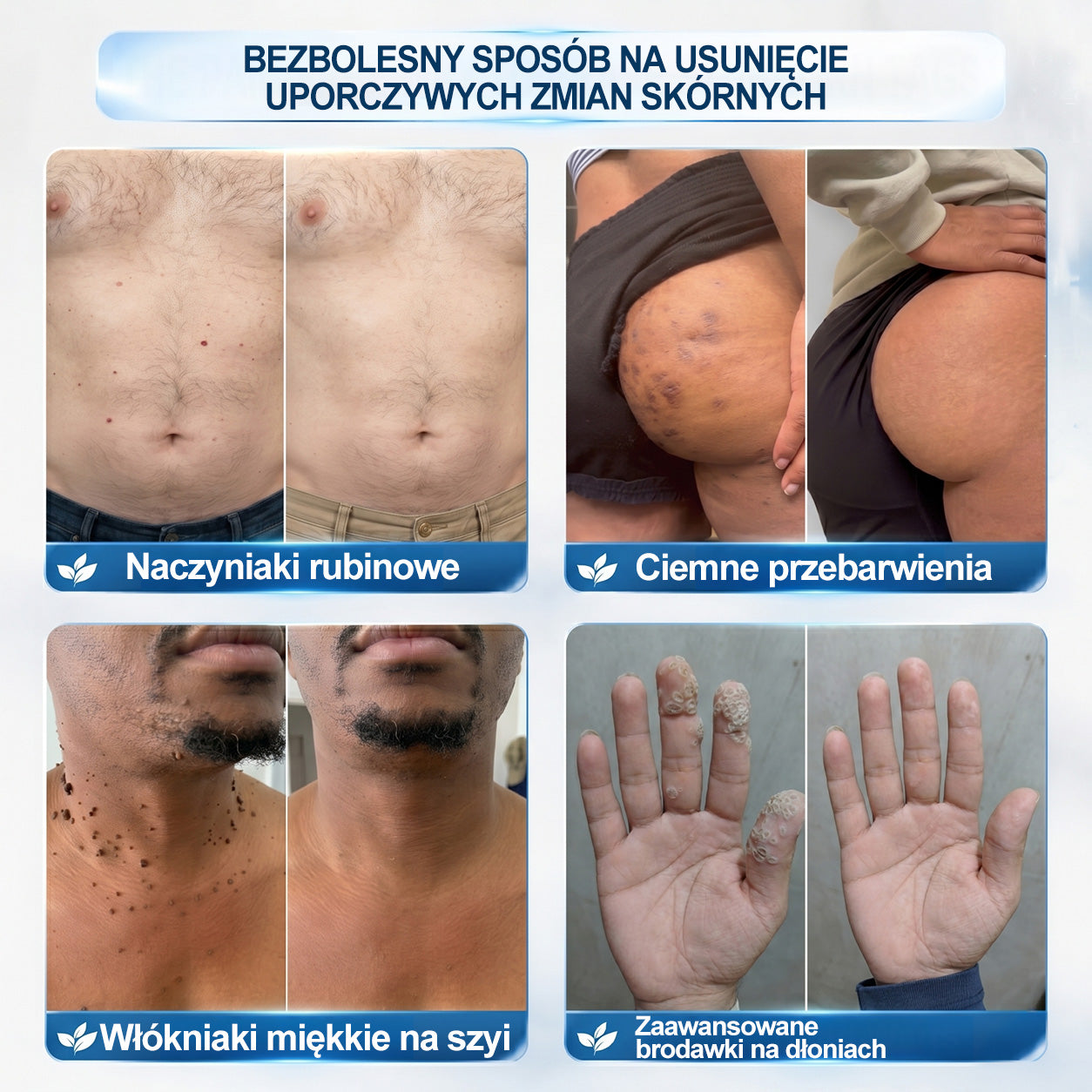 𝐏i𝐜𝐝o®7 𝑫𝒏𝒊 𝑷𝒓𝒆𝒑𝒂𝒓𝒂𝒕 𝑫𝒐 𝑼𝒔𝒖𝒘𝒂𝒏𝒊𝒂 𝑾łó𝒌𝒏𝒊𝒂𝒌ó𝒘 𝑴𝒊ę𝒌𝒌𝒊𝒄𝒉 𝑰 𝑷𝒓𝒛𝒆𝒃𝒂𝒓𝒘𝒊𝒆ń(𝐁𝐞𝐳 𝐁ó𝐥𝐮, 𝐁𝐞𝐳 𝐁𝐥𝐢𝐳𝐧 – 𝐑𝐨𝐥𝐥-𝐨𝐧)💜💜