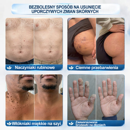 𝐏i𝐜𝐝o®7 𝑫𝒏𝒊 𝑷𝒓𝒆𝒑𝒂𝒓𝒂𝒕 𝑫𝒐 𝑼𝒔𝒖𝒘𝒂𝒏𝒊𝒂 𝑾łó𝒌𝒏𝒊𝒂𝒌ó𝒘 𝑴𝒊ę𝒌𝒌𝒊𝒄𝒉 𝑰 𝑷𝒓𝒛𝒆𝒃𝒂𝒓𝒘𝒊𝒆ń(𝐁𝐞𝐳 𝐁ó𝐥𝐮, 𝐁𝐞𝐳 𝐁𝐥𝐢𝐳𝐧 – 𝐑𝐨𝐥𝐥-𝐨𝐧)🩵🩵