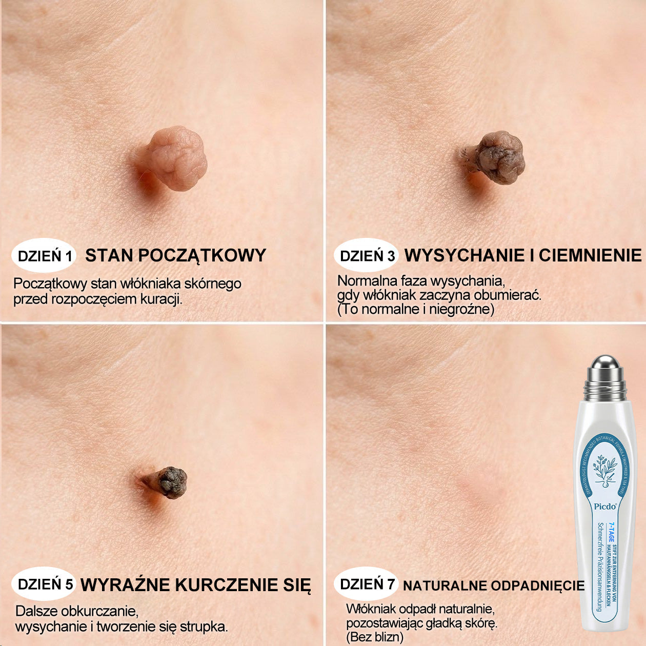 𝐏i𝐜𝐝o®7 𝑫𝒏𝒊 𝑷𝒓𝒆𝒑𝒂𝒓𝒂𝒕 𝑫𝒐 𝑼𝒔𝒖𝒘𝒂𝒏𝒊𝒂 𝑾łó𝒌𝒏𝒊𝒂𝒌ó𝒘 𝑴𝒊ę𝒌𝒌𝒊𝒄𝒉 𝑰 𝑷𝒓𝒛𝒆𝒃𝒂𝒓𝒘𝒊𝒆ń(𝐁𝐞𝐳 𝐁ó𝐥𝐮, 𝐁𝐞𝐳 𝐁𝐥𝐢𝐳𝐧 – 𝐑𝐨𝐥𝐥-𝐨𝐧)💛💛