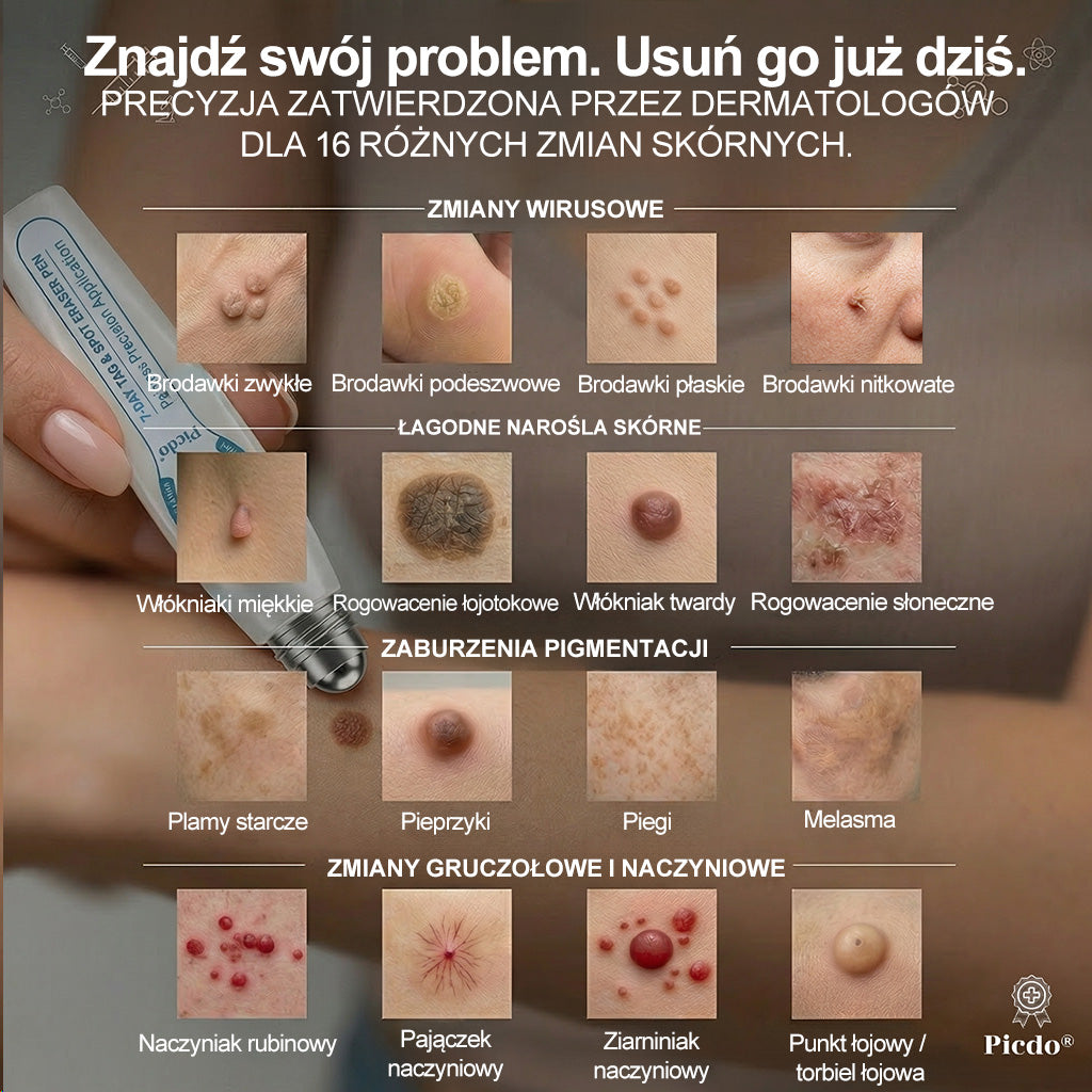 𝐏i𝐜𝐝o®7 𝑫𝒏𝒊 𝑷𝒓𝒆𝒑𝒂𝒓𝒂𝒕 𝑫𝒐 𝑼𝒔𝒖𝒘𝒂𝒏𝒊𝒂 𝑾łó𝒌𝒏𝒊𝒂𝒌ó𝒘 𝑴𝒊ę𝒌𝒌𝒊𝒄𝒉 𝑰 𝑷𝒓𝒛𝒆𝒃𝒂𝒓𝒘𝒊𝒆ń(𝐁𝐞𝐳 𝐁ó𝐥𝐮, 𝐁𝐞𝐳 𝐁𝐥𝐢𝐳𝐧 – 𝐑𝐨𝐥𝐥-𝐨𝐧)💜💜