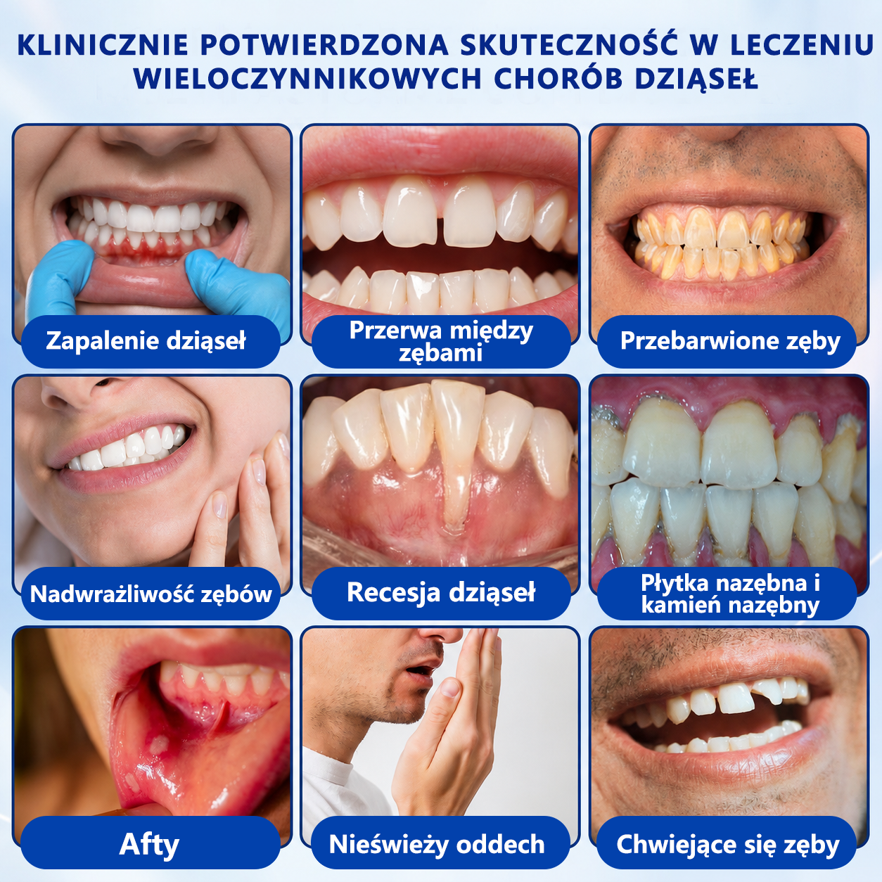 🌱🌱𝑮𝒍𝒊𝒎𝒎𝒆𝒓𝒍𝒚® 𝑮𝒖𝒎𝑹𝒆𝒗𝒊𝒗𝒆 𝒁̇𝒆𝒍 𝒅𝒐 𝑹𝒆𝒈𝒆𝒏𝒆𝒓𝒂𝒄𝒋𝒊 𝑫𝒛𝒊𝒂̨𝒔𝒆ł