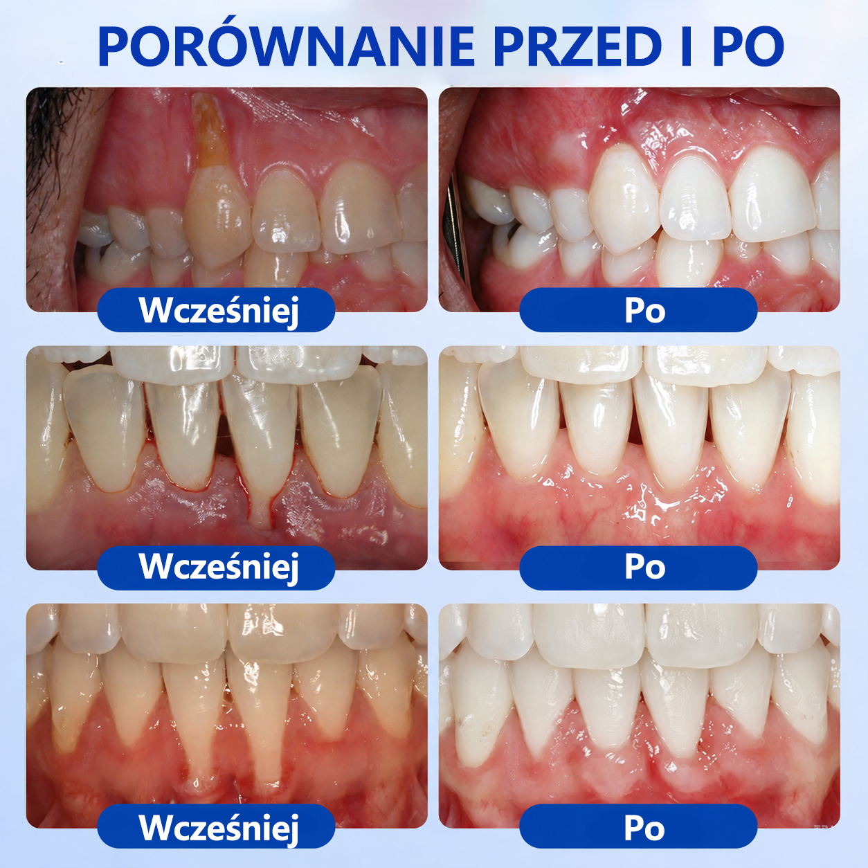 🌱🌱𝑮𝒍𝒊𝒎𝒎𝒆𝒓𝒍𝒚® 𝑮𝒖𝒎𝑹𝒆𝒗𝒊𝒗𝒆 𝒁̇𝒆𝒍 𝒅𝒐 𝑹𝒆𝒈𝒆𝒏𝒆𝒓𝒂𝒄𝒋𝒊 𝑫𝒛𝒊𝒂̨𝒔𝒆ł